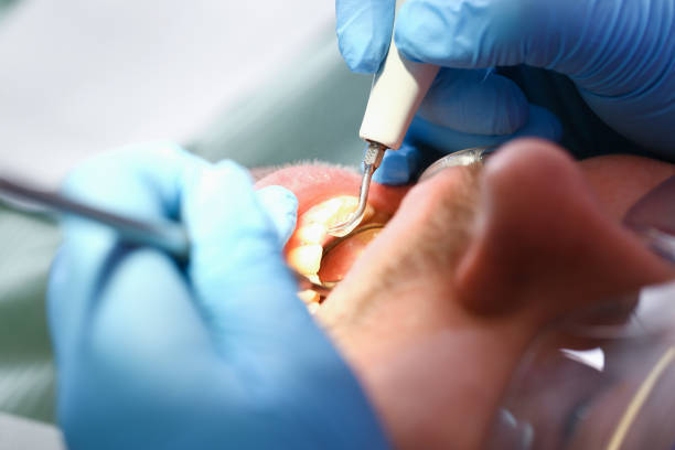 Best Walk-In Emergency Dental Services in Heppner, OR